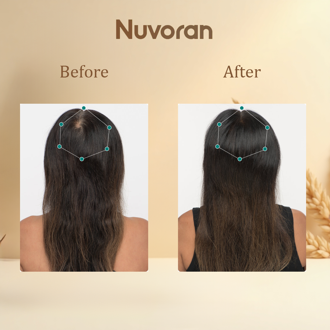 Nuvoran™ Rosemary Hair Growth Tonic